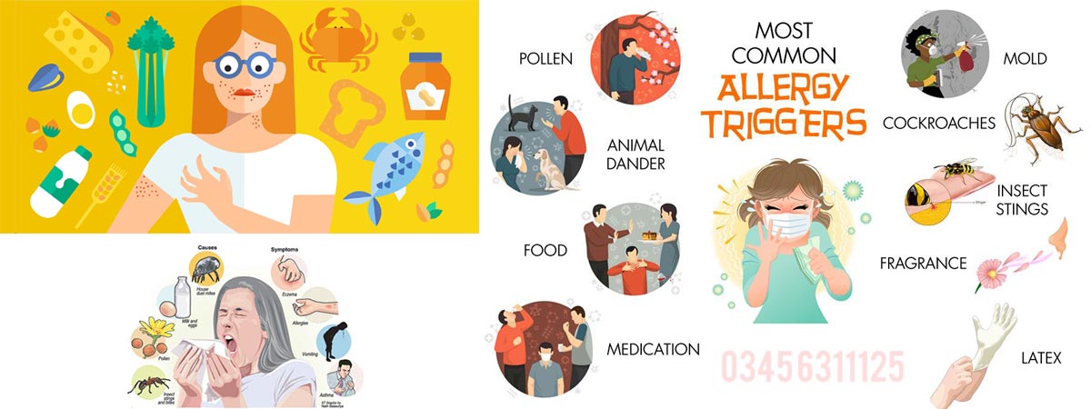 Allergy Causes, Symptoms and Treatment