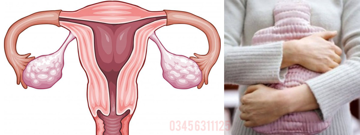 Amenorrhea Causes, Symptoms and Treatment