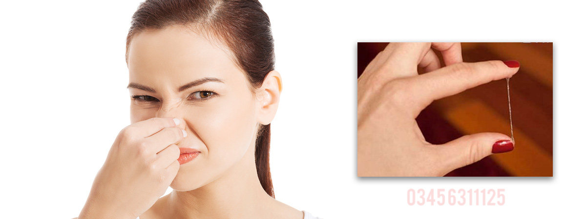 Leukorrhea Causes, Symptoms and Treatment