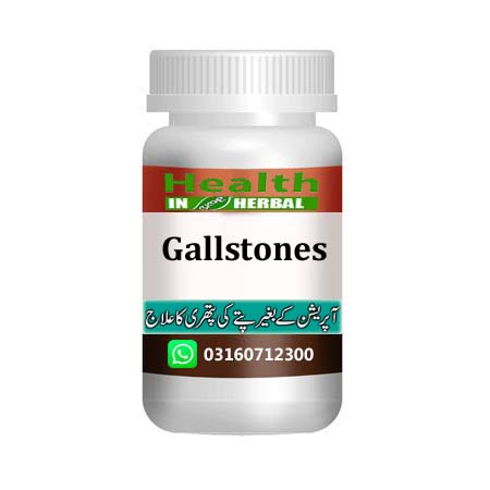 BileMend™ Herbal Treatment of Gallstones